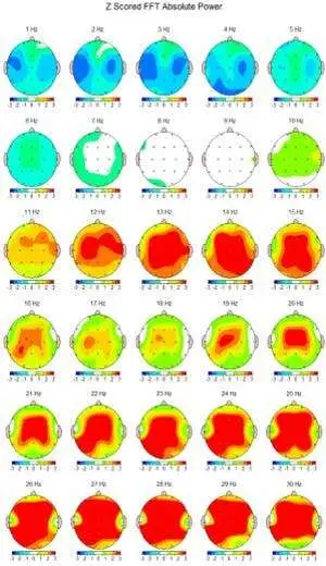 brain awareness1