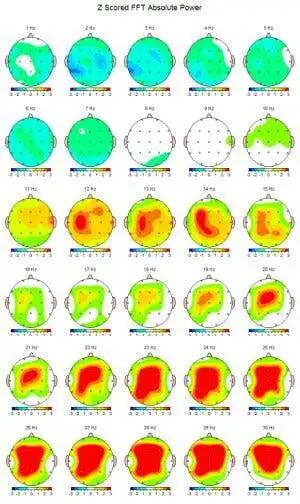 brain awareness2